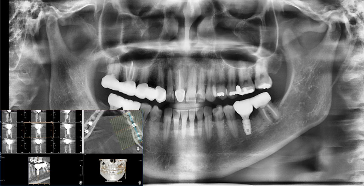 radiograph after delivery.