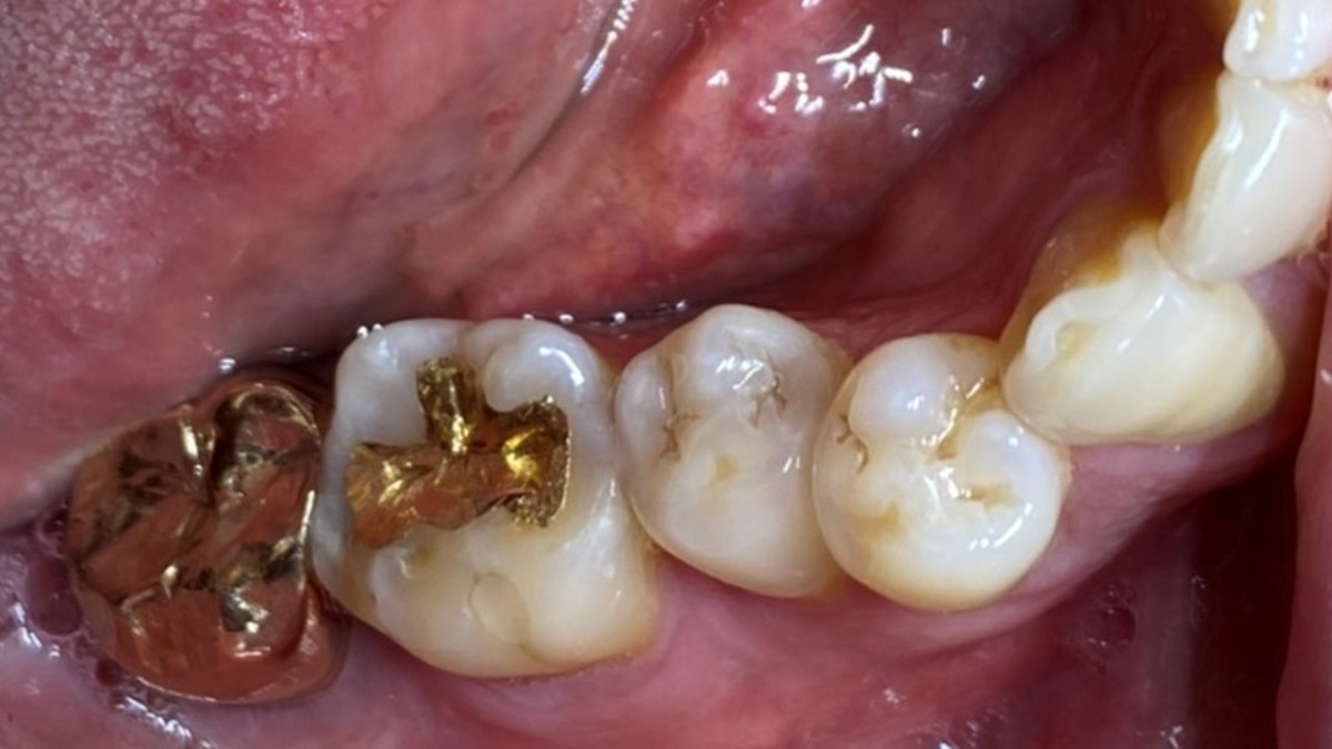 photo on the day of the first visit